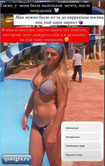 Балинская до и после пластики Анастасия Балинская сделала очередную пластическую операцию, надеясь, что послед