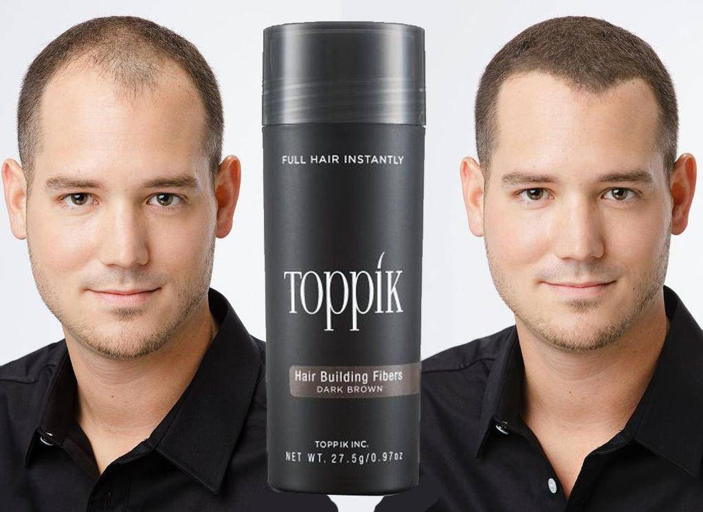 Toppik: как скрыть облысение и вернуть уверенность