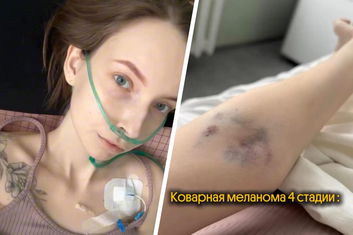 Пермячке с меланомой четвертой стадии срочно требуется донорская кровь